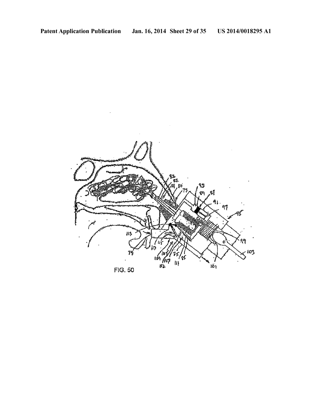 NASAL DELIVERY - diagram, schematic, and image 30