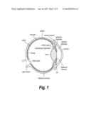 METHOD OF REDUCING INTRAOCULAR PRESSURE IN HUMANS diagram and image