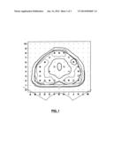 SYSTEM AND METHOD FOR IMAGE-GUIDED THERAPY PLANNING AND PROCEDURE diagram and image