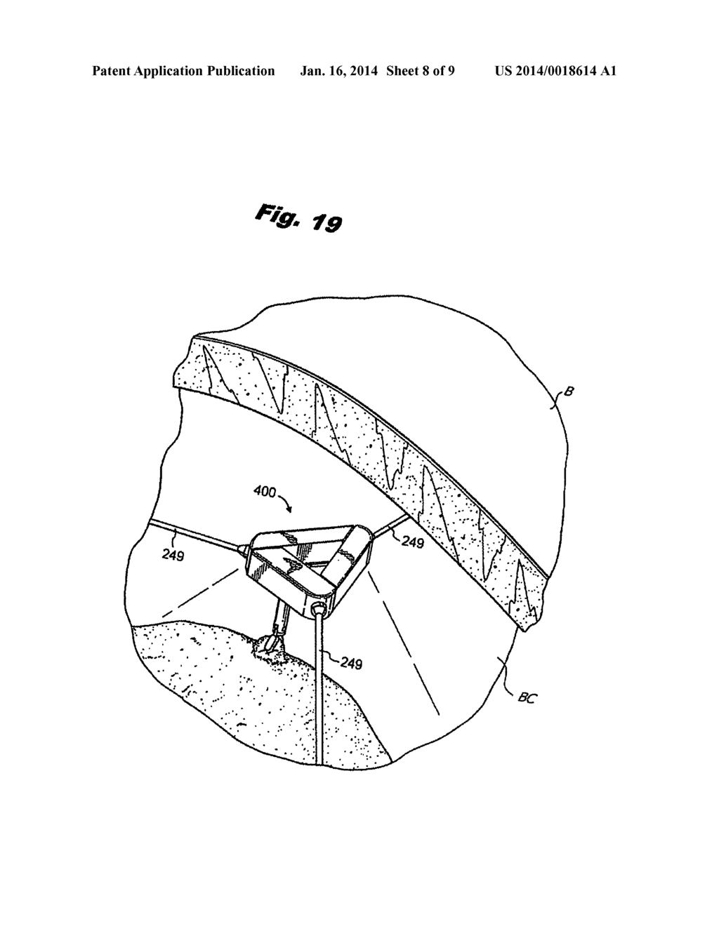 LAPAROSCOPIC SCAFFOLD ASSEMBLY - diagram, schematic, and image 09