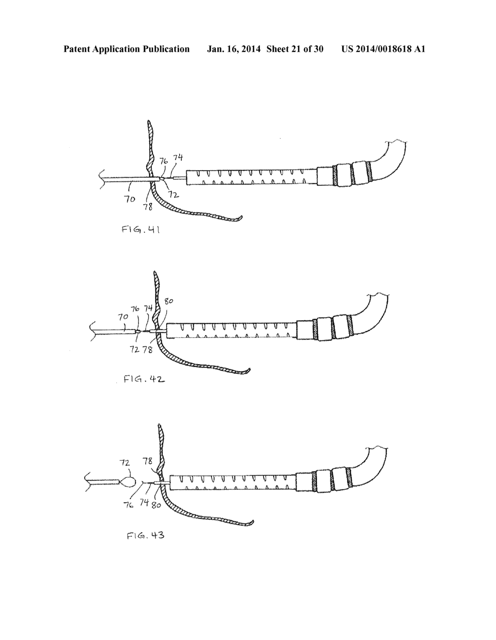 Access Systems and Methods of Intra-Abdominal Surgery - diagram, schematic, and image 22