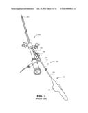 SYSTEMS FOR REDUCING FLUID LEAKAGE AND SPRAY-BACK FROM MEDICAL PROCEDURES diagram and image