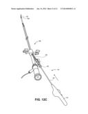 SYSTEMS FOR REDUCING FLUID LEAKAGE AND SPRAY-BACK FROM MEDICAL PROCEDURES diagram and image