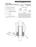 COLONOSCOPE CLOSURE DEVICE diagram and image