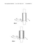 COLONOSCOPE CLOSURE DEVICE diagram and image