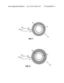 COLONOSCOPE CLOSURE DEVICE diagram and image