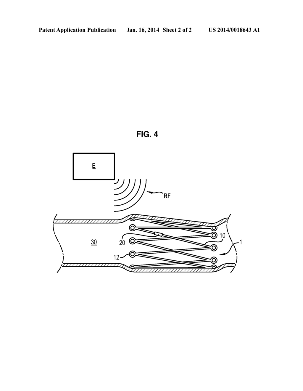 SELF-CONTAINED SYSTEM SUITABLE FOR BEING INSERTED INTO AN ANATOMICAL     CAVITY - diagram, schematic, and image 03