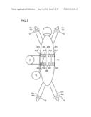 PAD TRAY diagram and image