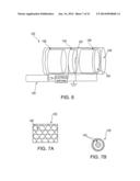 SYSTEM AND METHOD FOR DETECTING CRITICAL STRUCTURES USING ULTRASOUND diagram and image