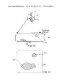 SYSTEM AND METHOD FOR DETECTING CRITICAL STRUCTURES USING ULTRASOUND diagram and image