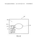 SYSTEM AND METHOD FOR DETECTING CRITICAL STRUCTURES USING ULTRASOUND diagram and image