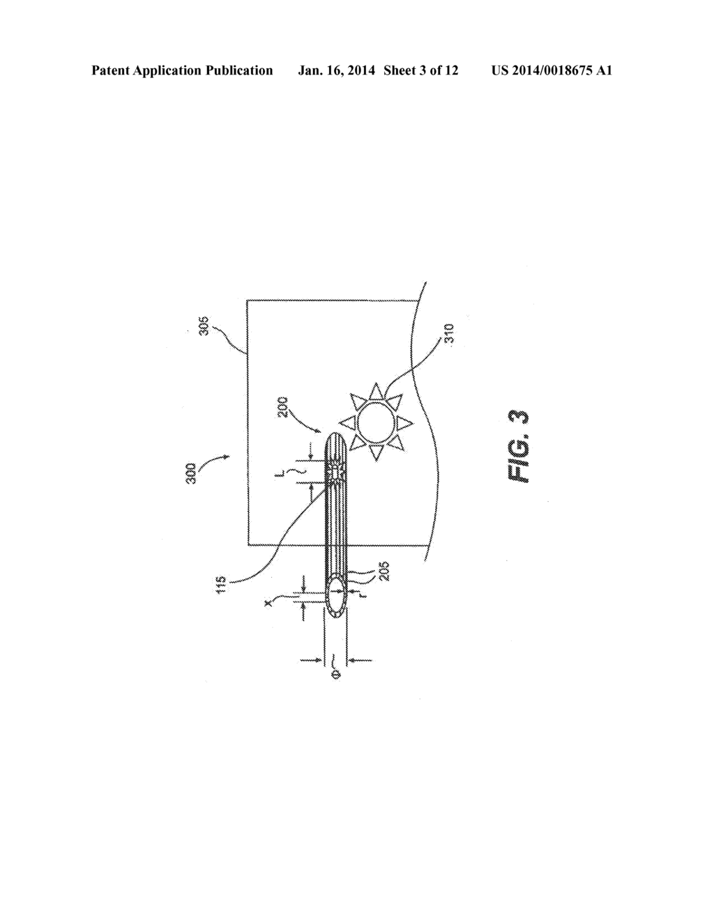 APPARATUS AND METHOD FOR EXTERNAL BEAM RADIATION DISTRIBUTION MAPPING - diagram, schematic, and image 04