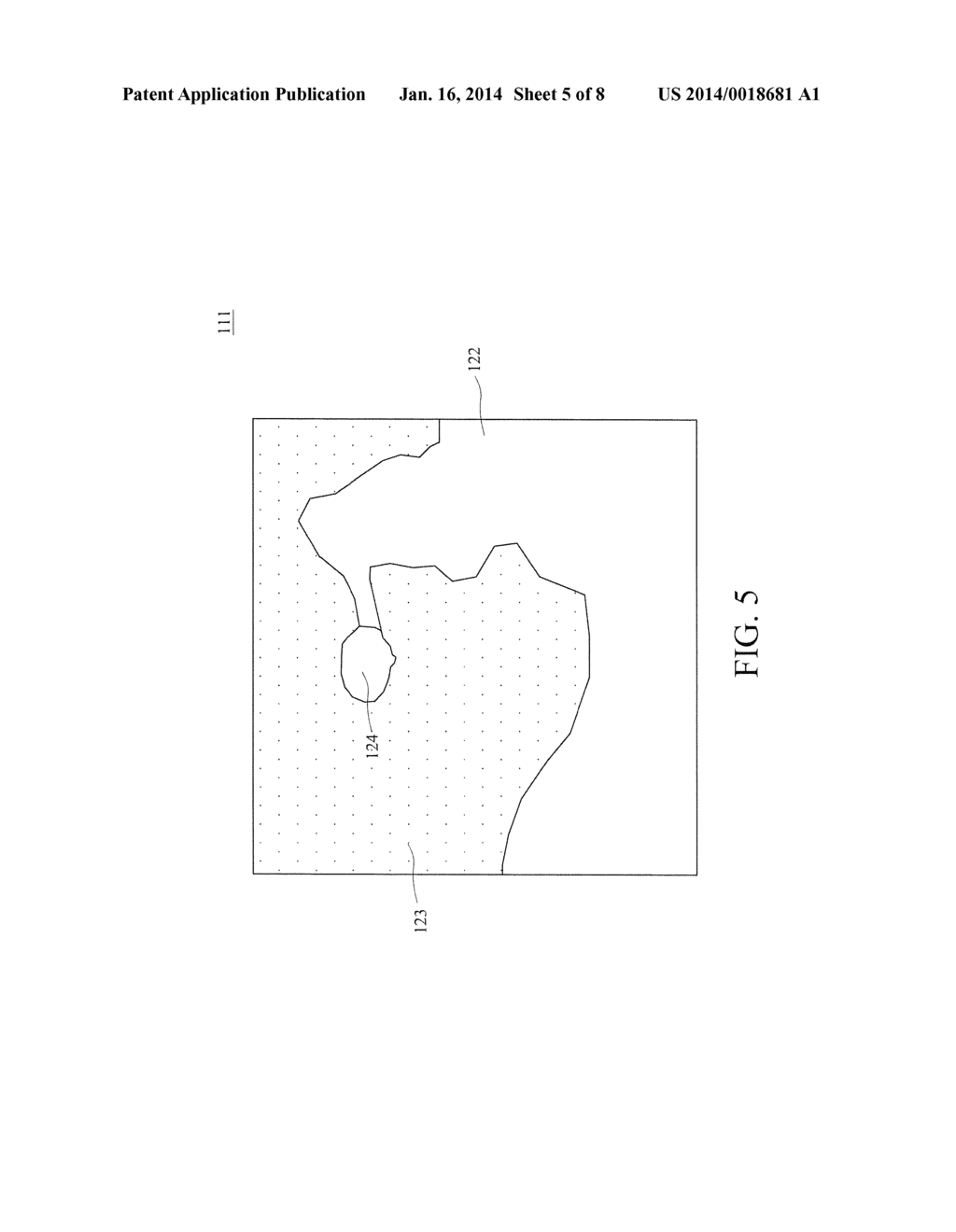 ULTRASOUND IMAGING BREAST TUMOR DETECTION AND DIAGNOSTIC SYSTEM AND METHOD - diagram, schematic, and image 06