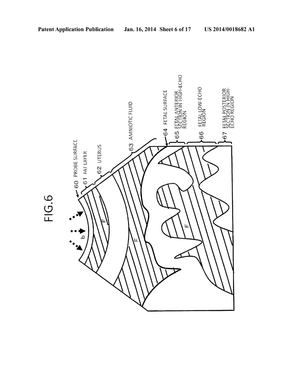 ULTRASONIC DIAGNOSTIC APPARATUS AND ULTRASONIC DIAGNOSTIC IMAGE RENDERING     METHOD - diagram, schematic, and image 07