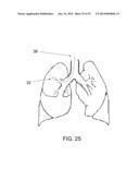 PROTECTIVE MATRIX FOR INTRACORPOREAL BIOSENSORS THAT IMPROVES     GASTROINTESTINAL LEAK DETECTION, DETECTS AIR LEAKS AFTER LUNG SURGERY,     AND MEASURES CARDIAC OUTPUT AFTER HEART SURGERY diagram and image