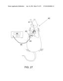 PROTECTIVE MATRIX FOR INTRACORPOREAL BIOSENSORS THAT IMPROVES     GASTROINTESTINAL LEAK DETECTION, DETECTS AIR LEAKS AFTER LUNG SURGERY,     AND MEASURES CARDIAC OUTPUT AFTER HEART SURGERY diagram and image