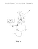 PROTECTIVE MATRIX FOR INTRACORPOREAL BIOSENSORS THAT IMPROVES     GASTROINTESTINAL LEAK DETECTION, DETECTS AIR LEAKS AFTER LUNG SURGERY,     AND MEASURES CARDIAC OUTPUT AFTER HEART SURGERY diagram and image