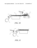 Alginate Wound Dressing and Method of Making the Same diagram and image