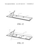 Alginate Wound Dressing and Method of Making the Same diagram and image