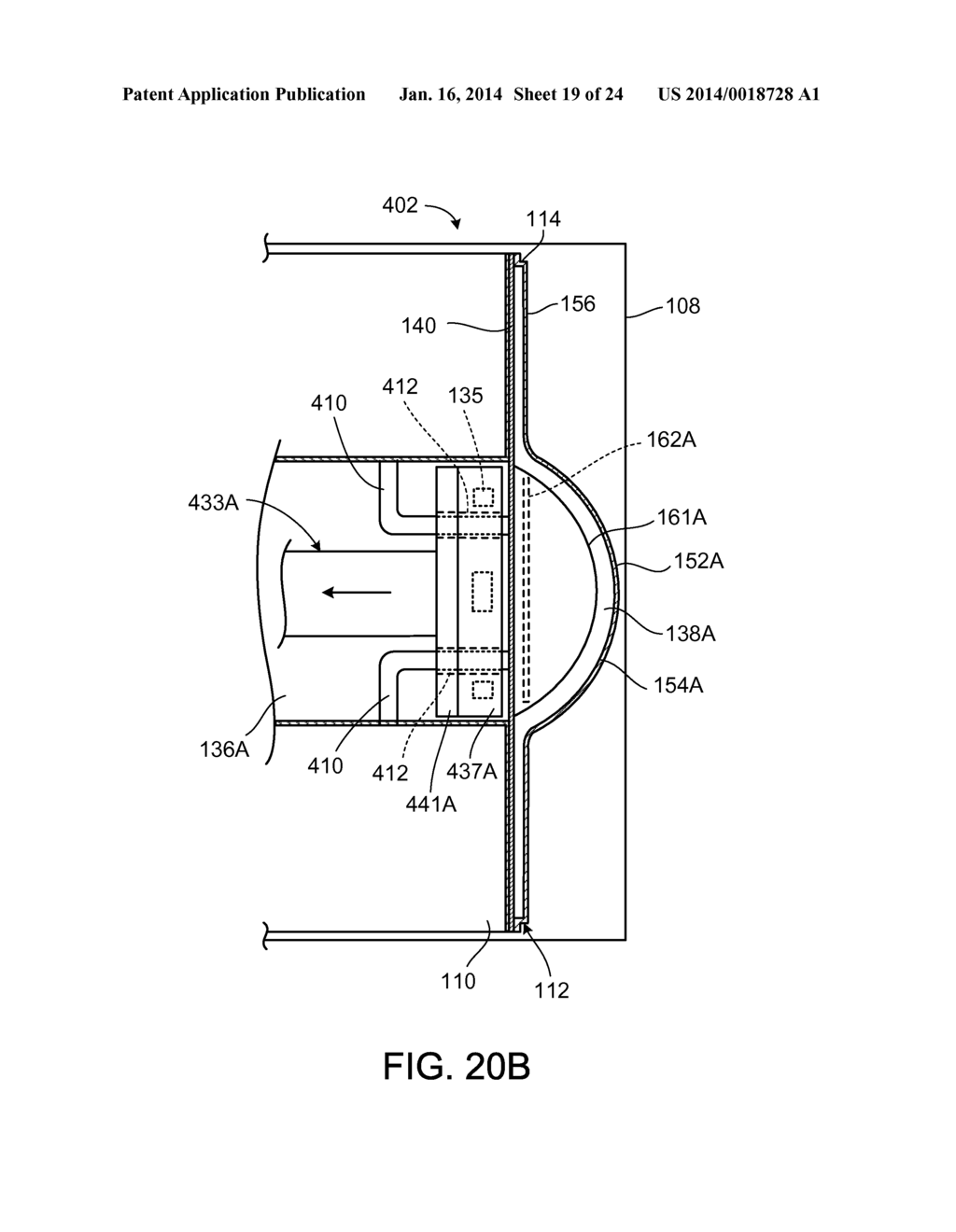 MEDICAL FLUID CASSETTES AND RELATED SYSTEMS AND METHODS - diagram, schematic, and image 20