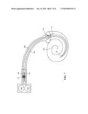 Implantable Fluid Delivery System with Floating Mass Transducer Driven     Pump diagram and image