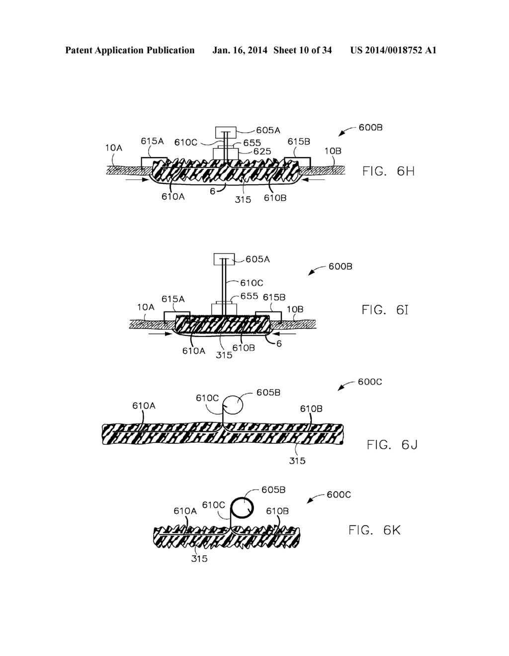 METHODS AND DRESSING SYSTEMS FOR PROMOTING HEALING OF INJURED TISSUE - diagram, schematic, and image 11