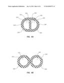 SELF-CENTERING CATHETER WITH ANTI-OCCLUSION FEATURES diagram and image