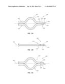 SELF-CENTERING CATHETER WITH ANTI-OCCLUSION FEATURES diagram and image