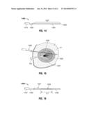 HEAT-DISTRIBUTION INDICATORS, THERMAL ZONE INDICATORS, ELECTROSURGICAL     SYSTEMS INCLUDING SAME AND METHODS OF DIRECTING ENERGY TO TISSUE USING     SAME diagram and image