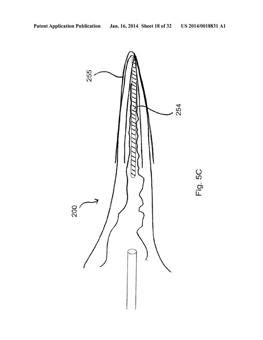 ATRIAL APPENDAGE OCCLUSION SYSTEMS AND METHODS OF USING THE SAME - diagram, schematic, and image 19