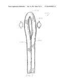 Method For Applying A Surgical Clip Having A Compliant Portion diagram and image