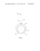 WIRE-GUIDED RECANALIZATION SYSTEM diagram and image