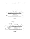 WIRE-GUIDED RECANALIZATION SYSTEM diagram and image