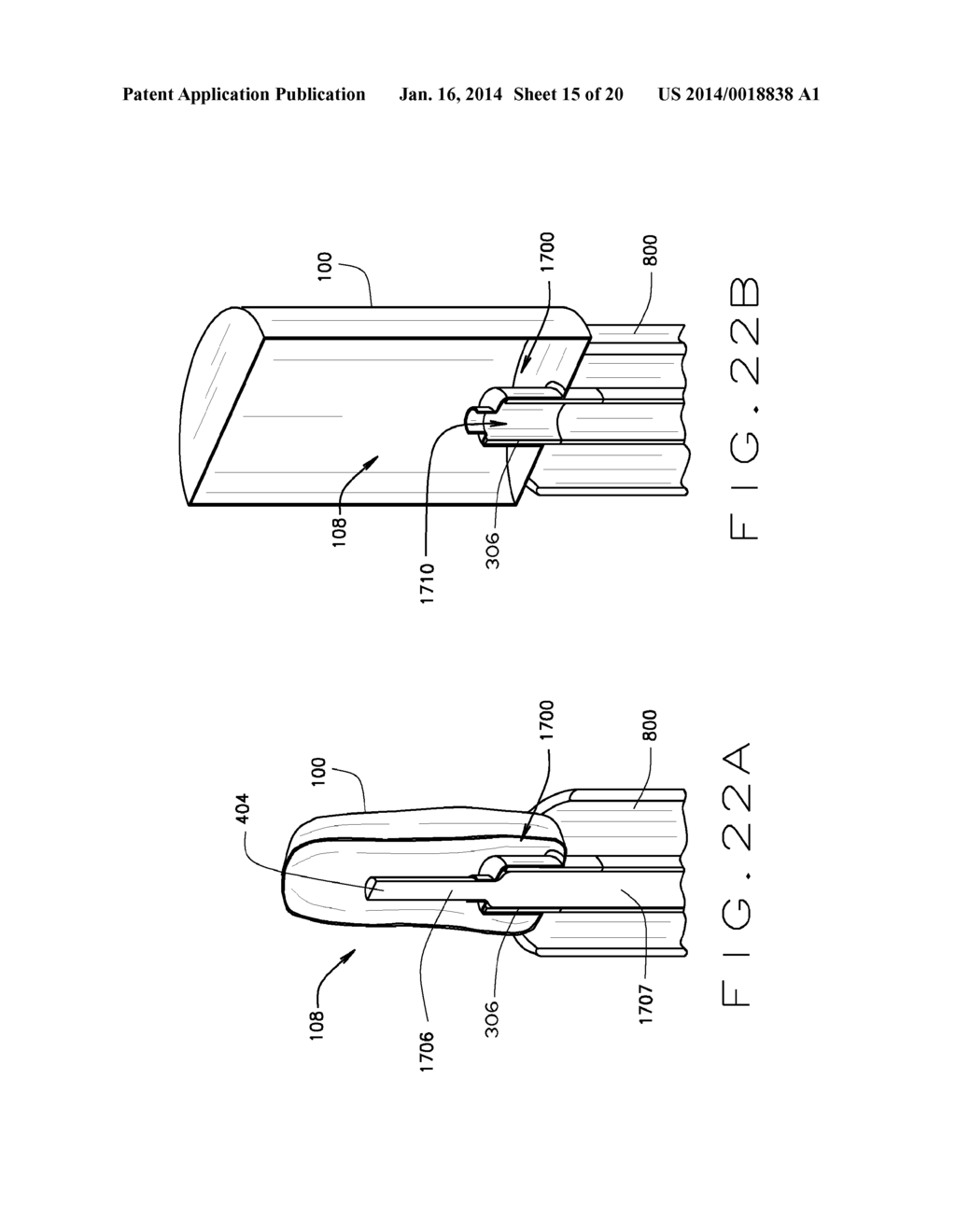 BLOCKSTENT DEVICE AND METHODS OF USE - diagram, schematic, and image 16