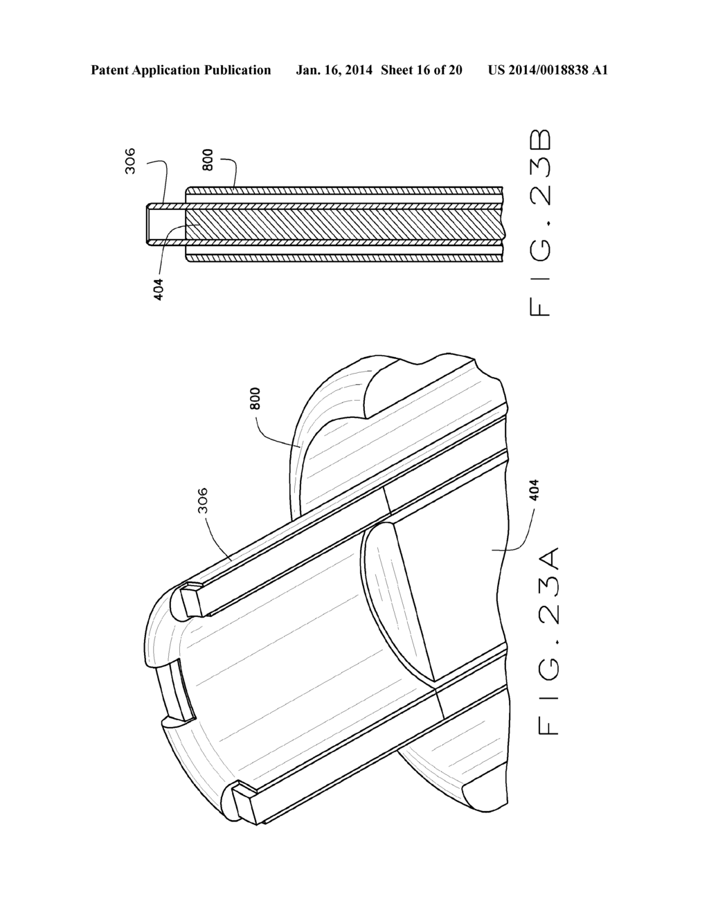 BLOCKSTENT DEVICE AND METHODS OF USE - diagram, schematic, and image 17