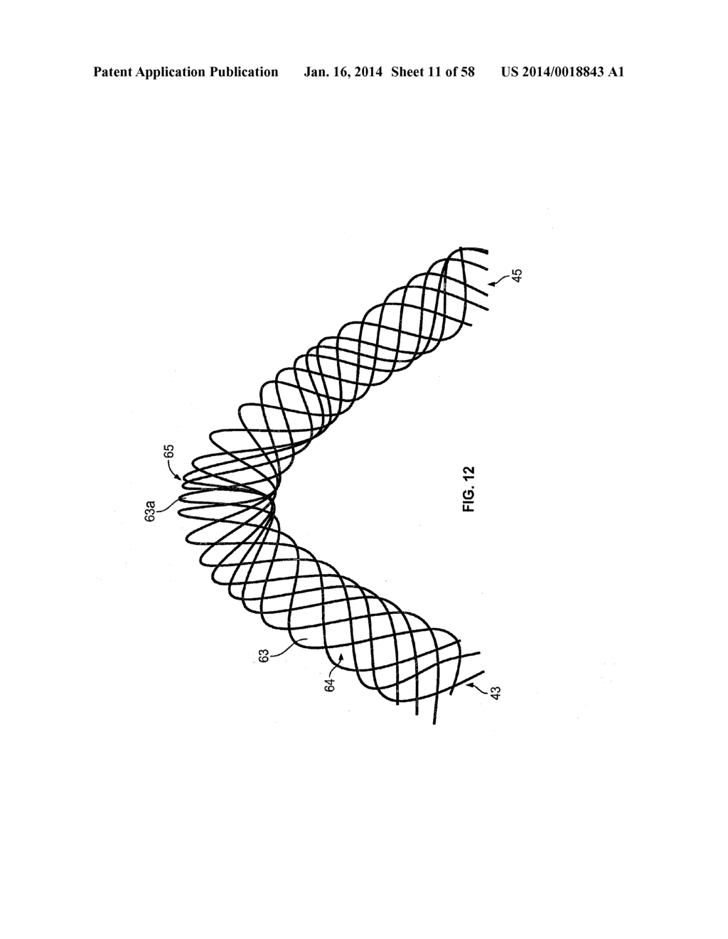 METHODS AND APPARATUS FOR LUMINAL STENTING - diagram, schematic, and image 12