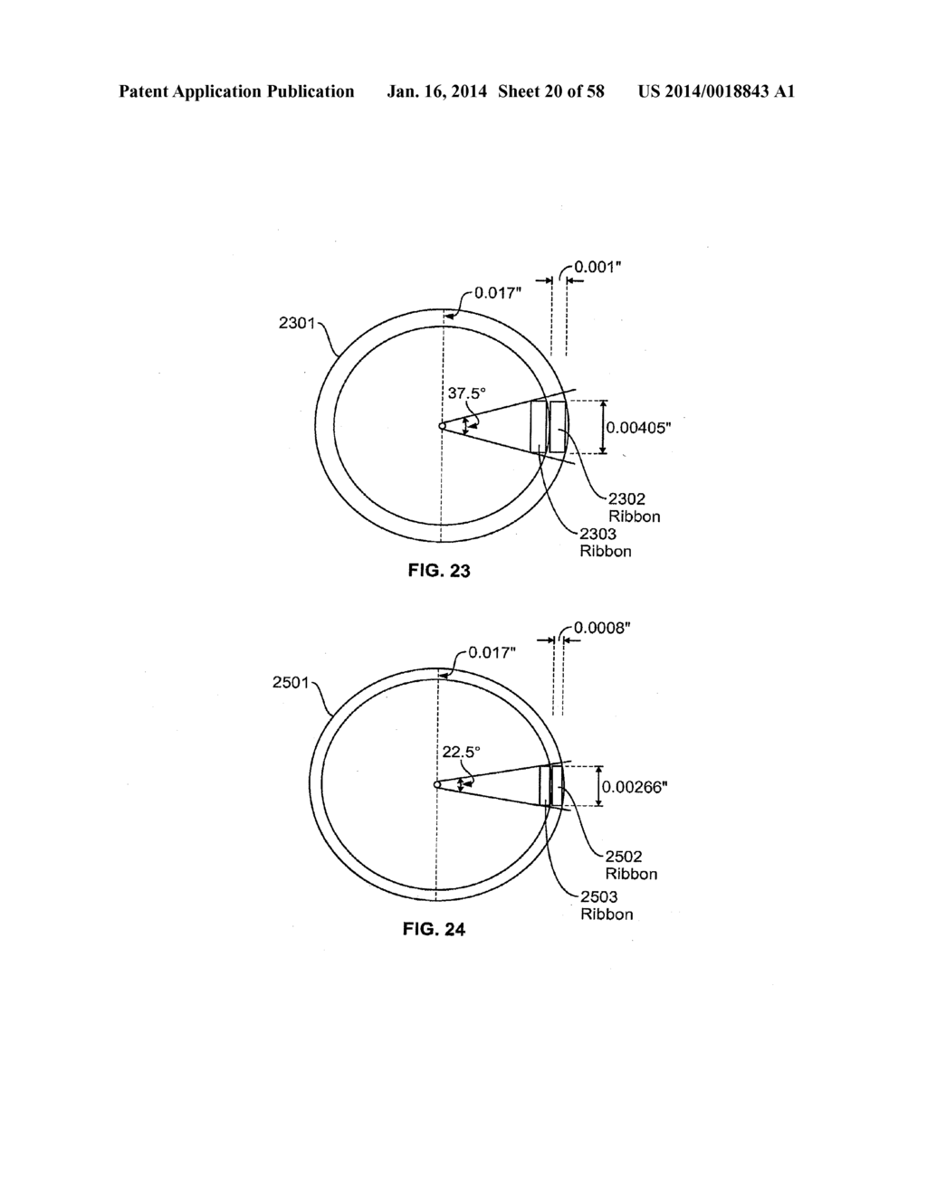 METHODS AND APPARATUS FOR LUMINAL STENTING - diagram, schematic, and image 21