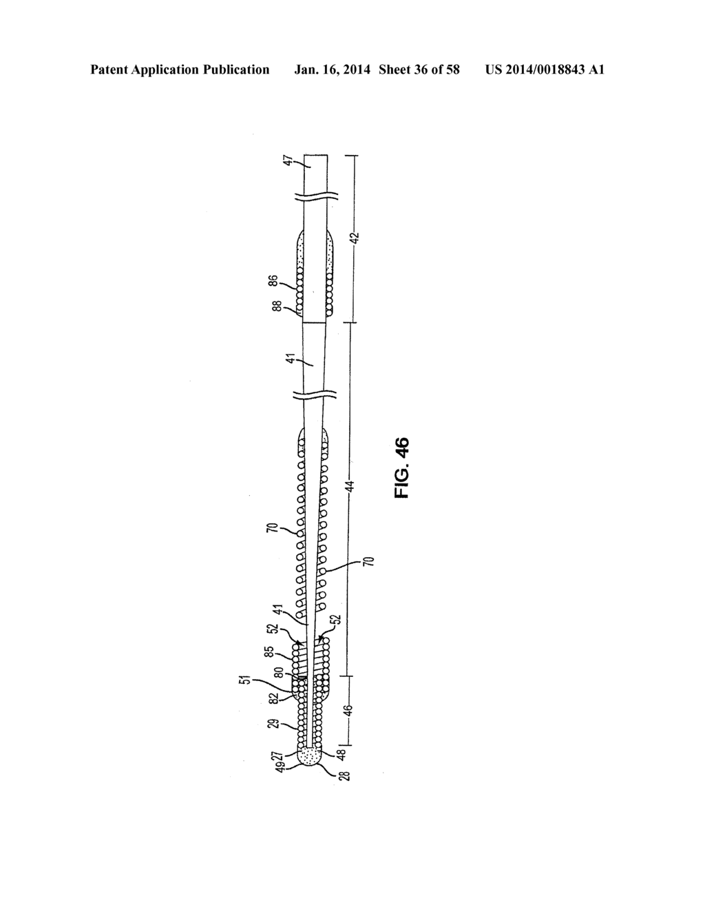 METHODS AND APPARATUS FOR LUMINAL STENTING - diagram, schematic, and image 37