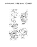 DEVICE AND METHOD FOR SECURING A SUTURE diagram and image