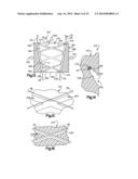 DEVICE AND METHOD FOR SECURING A SUTURE diagram and image