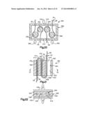 DEVICE AND METHOD FOR SECURING A SUTURE diagram and image