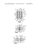 DEVICE AND METHOD FOR SECURING A SUTURE diagram and image