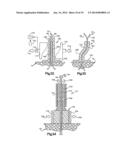 DEVICE AND METHOD FOR SECURING A SUTURE diagram and image