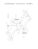 REVISABLE ANTERIOR CERVICAL PLATING SYSTEM diagram and image