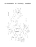 REVISABLE ANTERIOR CERVICAL PLATING SYSTEM diagram and image