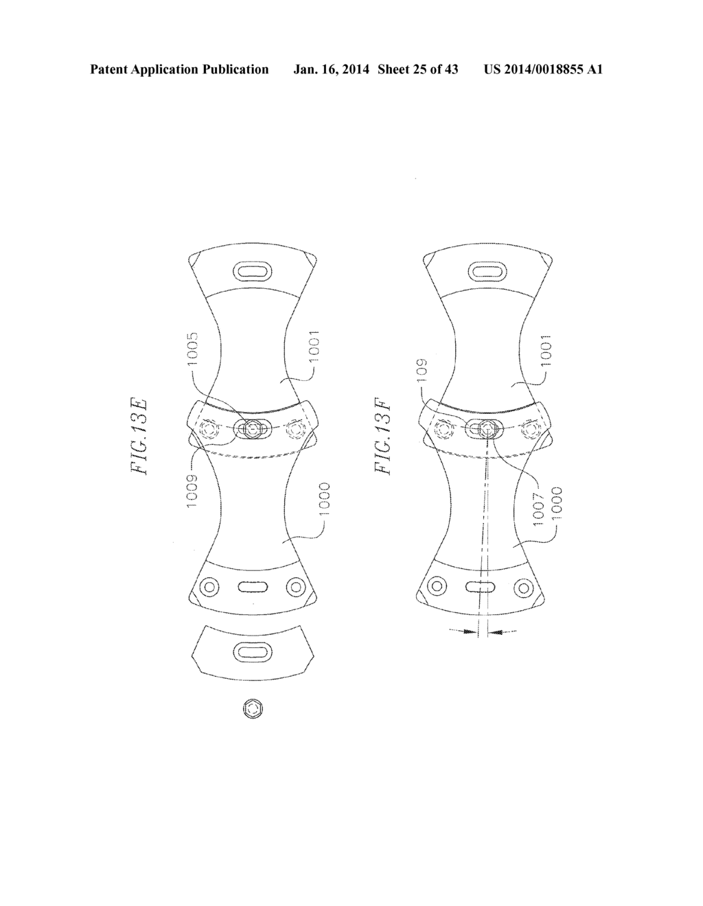 REVISABLE ANTERIOR CERVICAL PLATING SYSTEM - diagram, schematic, and image 26