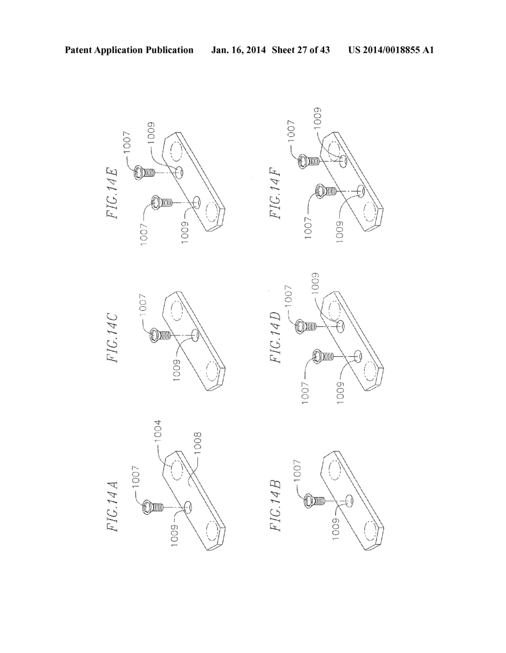 REVISABLE ANTERIOR CERVICAL PLATING SYSTEM - diagram, schematic, and image 28