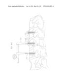 REVISABLE ANTERIOR CERVICAL PLATING SYSTEM diagram and image