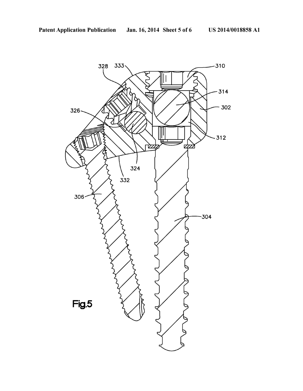 Device, Kit and Method for Correction of Spinal Deformity - diagram, schematic, and image 06