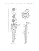 POLYAXIAL BONE ANCHOR WITH POP-ON SHANK, FRICTION FIT RETAINER, WINGED     INSERT AND LOW PROFILE EDGE LOCK diagram and image